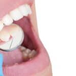 periodoncia