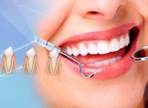 servicio-de-periodoncia